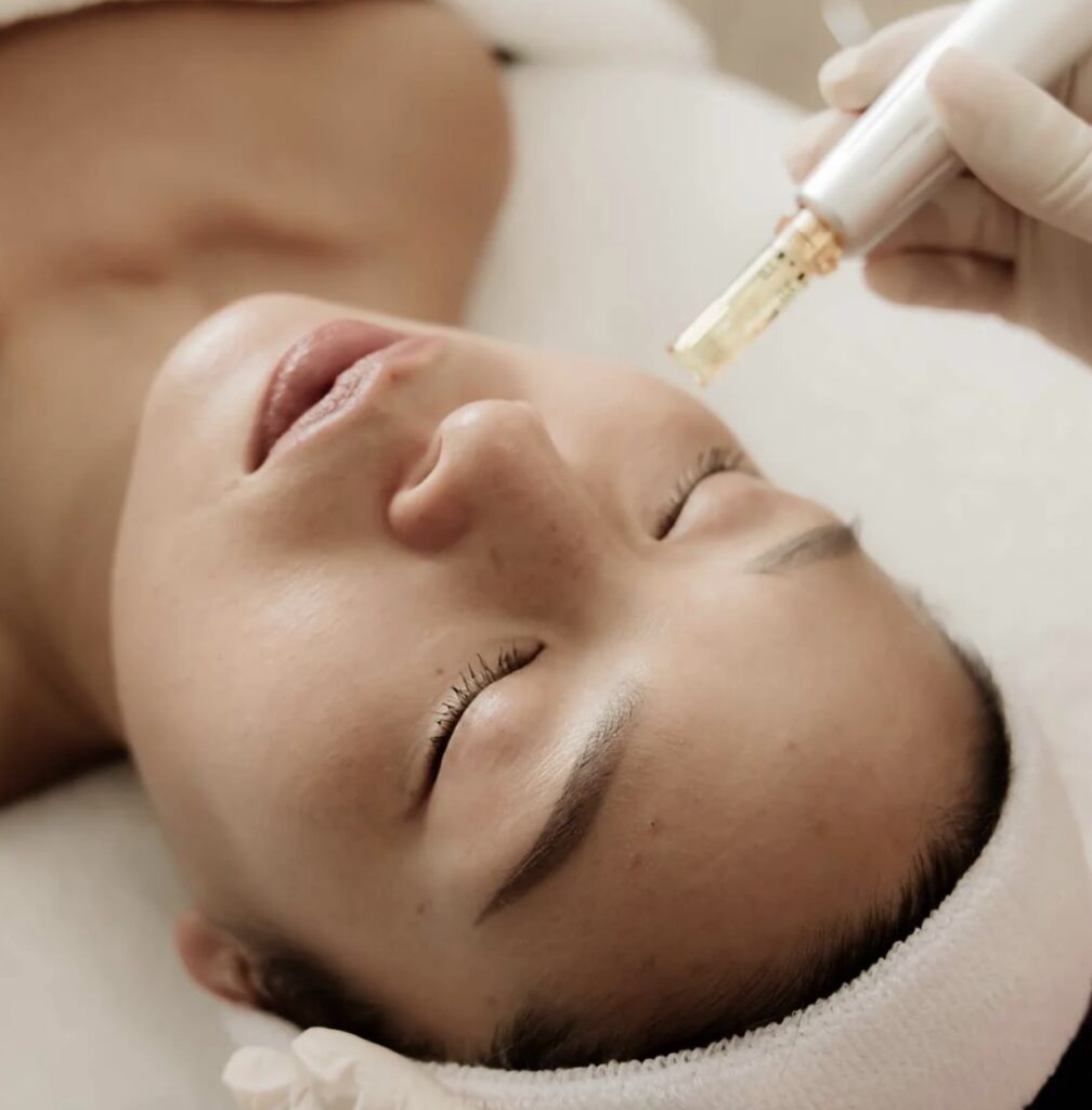 skin needling facial brisbane